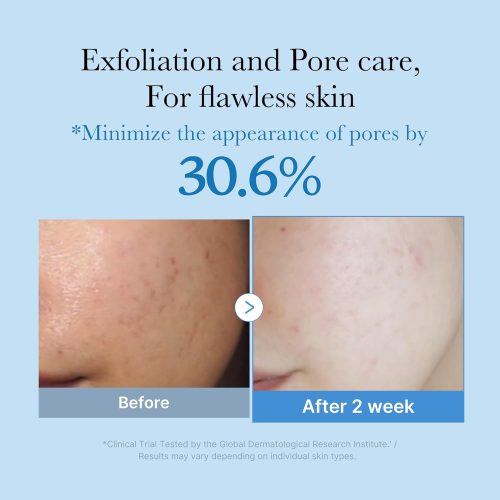 713rDL4GblL._AC_SL1500_