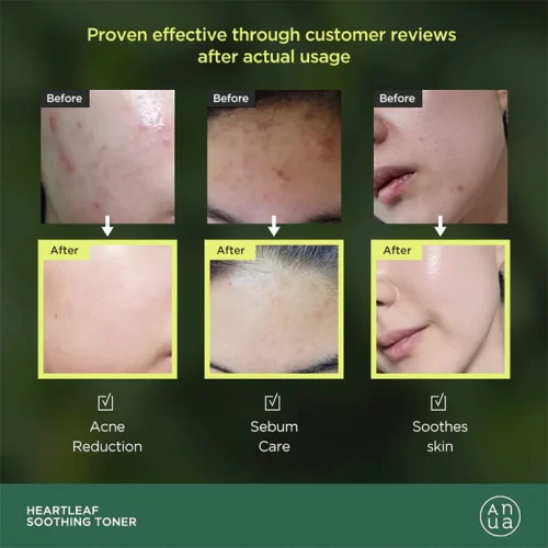 Heartleaf77_SoothingTonerHeartleaf7710_695x695