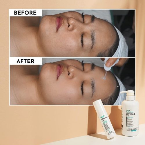 dm-cel-BNP-exfoliante-ge-2l